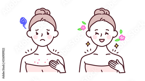 가슴에 난 여드름을 치료하는 여성