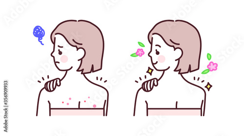 등 뒤에 여드름을 치료하는 여성