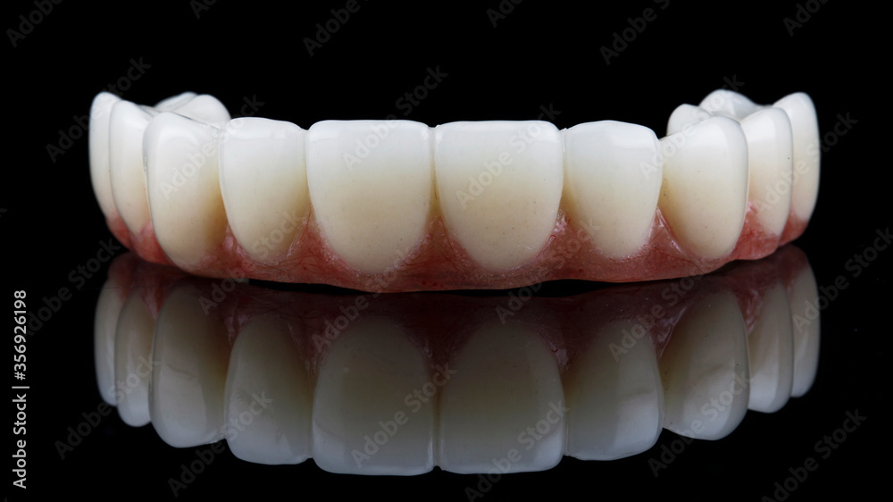 Dental prosthesis of the upper jaw with a pink gum, shot on a black background with reflection Dental prosthesis of the upper jaw with a pink gum, shot on a black background with reflection