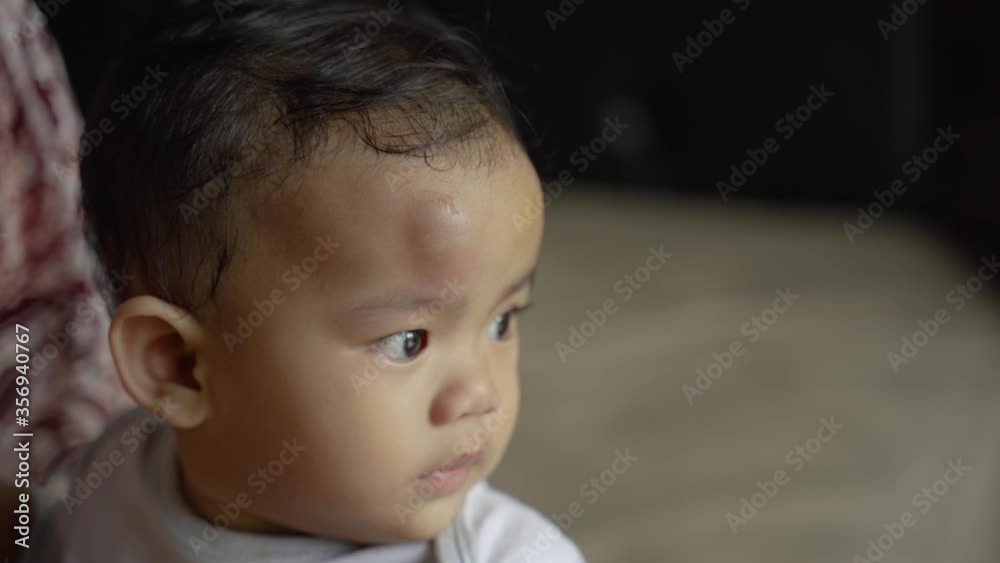 asian baby with swollen forehead after falling from bed asian baby with swollen forehead after falling from bed