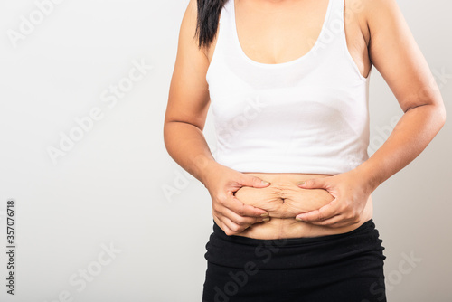 Close up of Asian mother woman showing stretch mark loose lower abdomen skin she fat after pregnancy baby birth, studio isolated on white background, Healthy belly overweight excess body concept photo