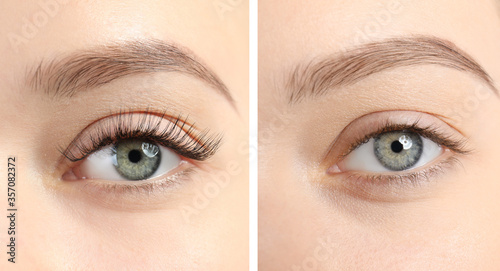 Fényképezés Collage with photos of young woman before and after eyelash extension procedure,
