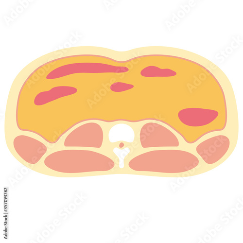 腹部断面図　内臓脂肪