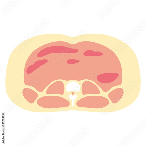 腹部断面図　皮下脂肪