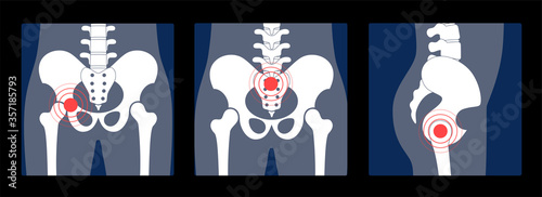 Skeleton x ray