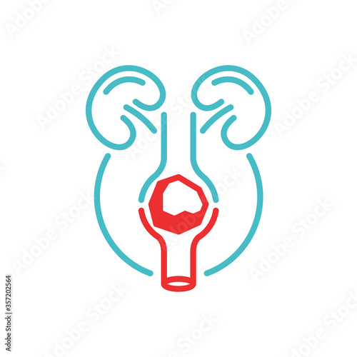 Kidney stone disease icon - urology surgery emblem - isolated vector medical picture photo