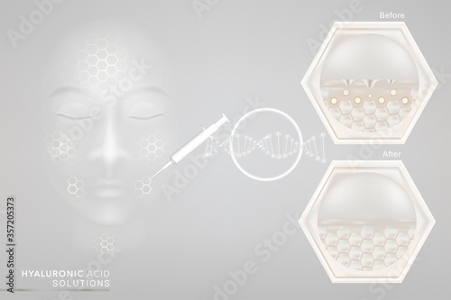 Hyaluronic acid before and after skin solutions ad, white collagen serum drop with cosmetic advertising background ready to use, illustration vector.