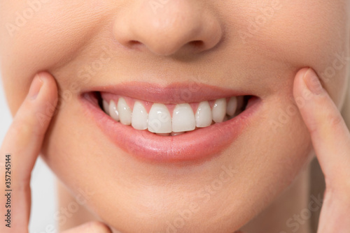 Teeth whitening, perfect smile
