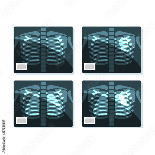 X-ray vector shot, roentgen flat radiology in medicine concept isolated illustration.