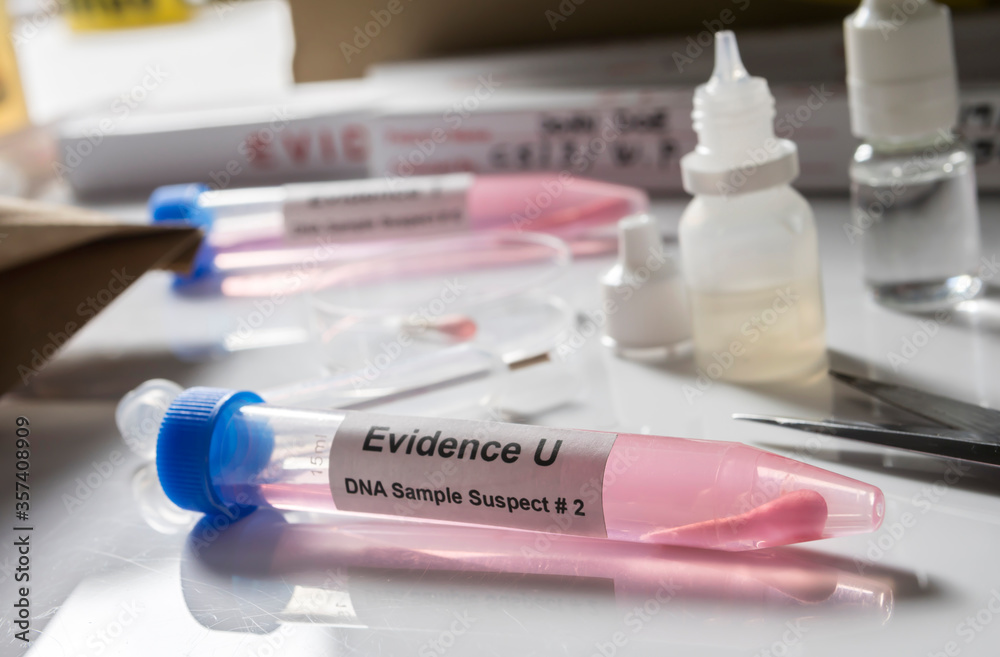 Hematological analysis with forensic test kit in a murder in a crime lab, conceptual image Hematological analysis with forensic test kit in a murder in a crime lab, conceptual image