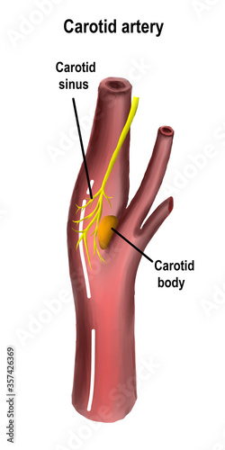 Carotid bulb and carotid body are the important structure keepng balance of human hemodynamic system. photo