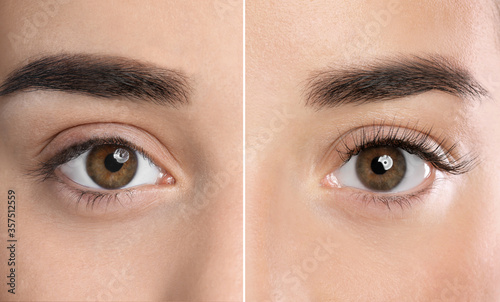 Photographie Collage with photos of young woman before and after eyelash extension procedure,