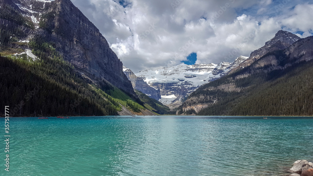 Lake Louise, one of the world's top ten scenic spots Lake Louise, one of the world's top ten scenic spots