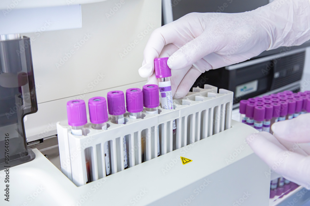 Medical laboratory blood tests doctor holds a wakutainer Medical laboratory blood tests doctor holds a wakutainer