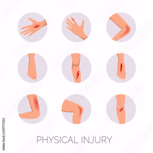 Human body physical injury round flat set. Open cut wounds and elbow bruise.