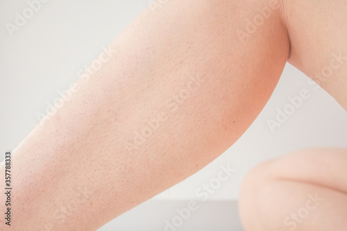 Laser hair removal on legs  female leg close-up on a white background  hair removal concept