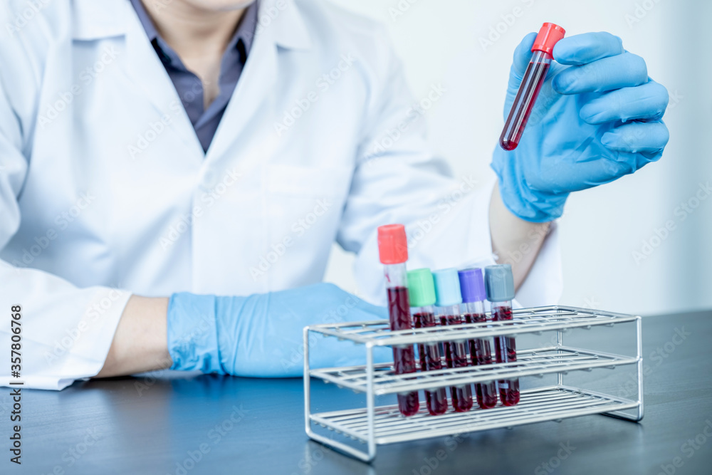 Professional doctors perform find virus tests from samples of blood tests to diagnose coronary virus infections analysis and sampling of infectious