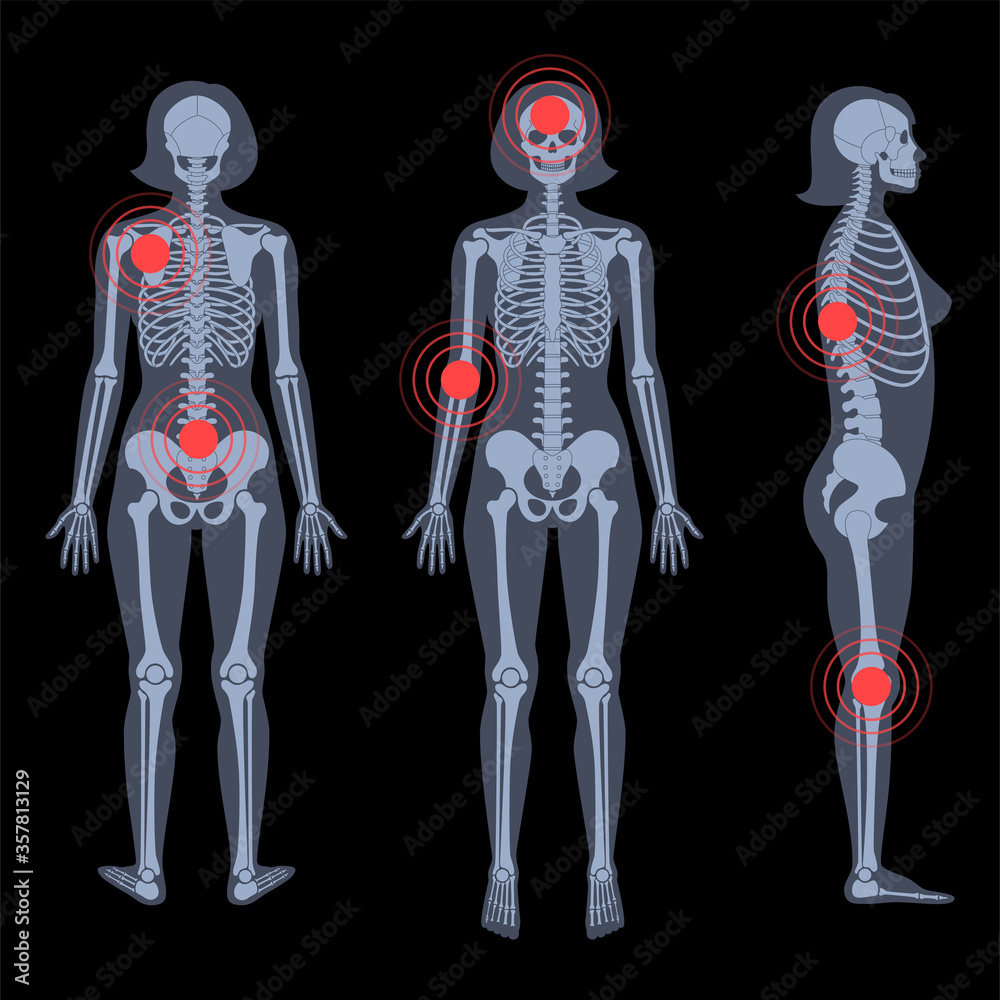Skeleton x ray Stock Vector Biology Diagrams