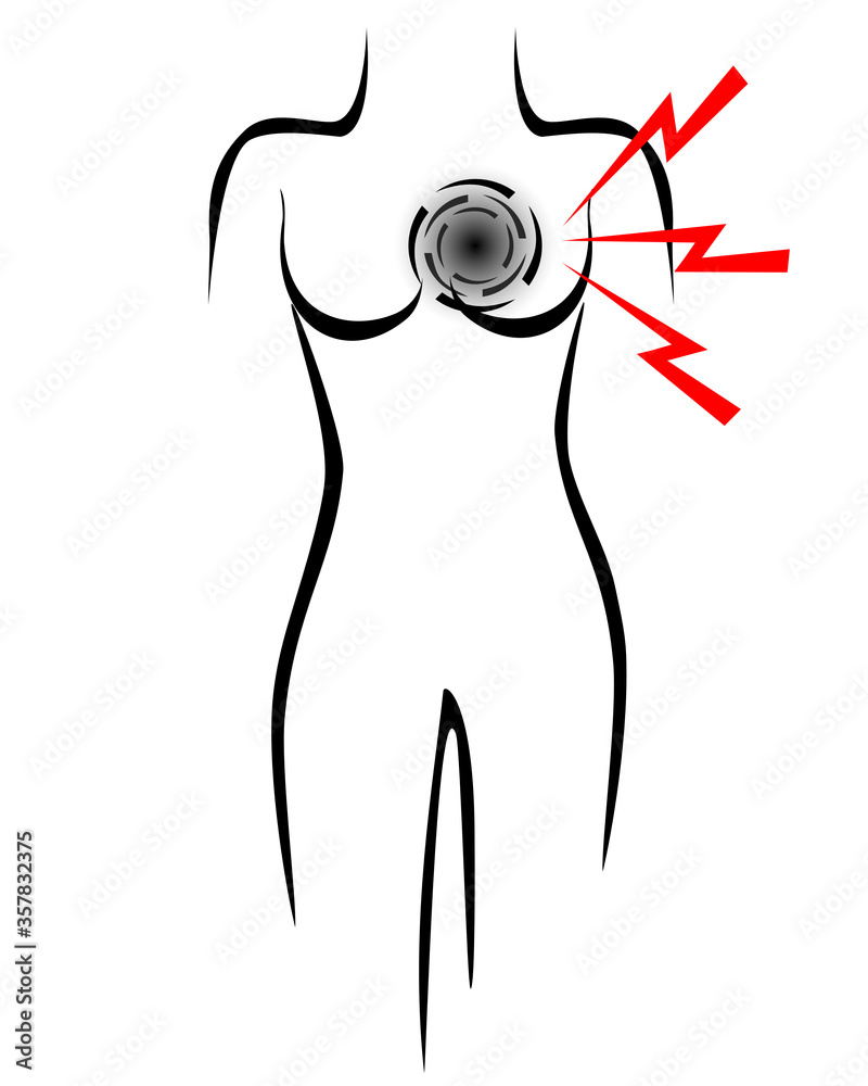 Fototapeta premium Stilisierter Frauenkörper mit Symbol für Herzinfarkt