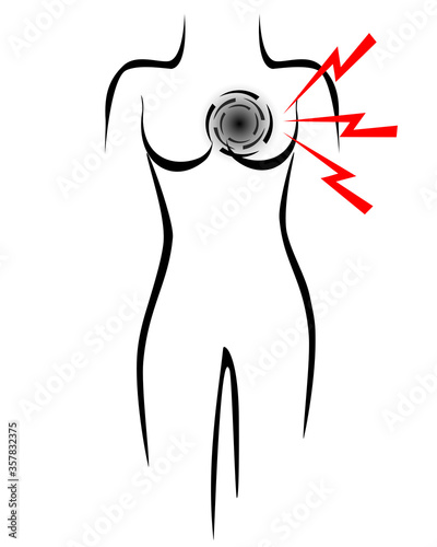 Stilisierter Frauenkörper mit Symbol für Herzinfarkt