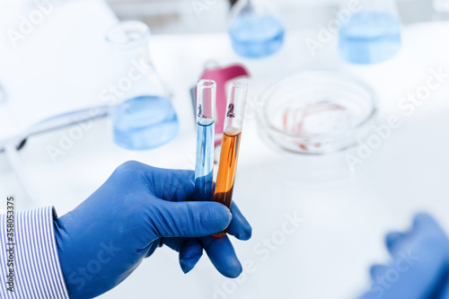 close up. scientist marking a Petri dish with viral bacteria.