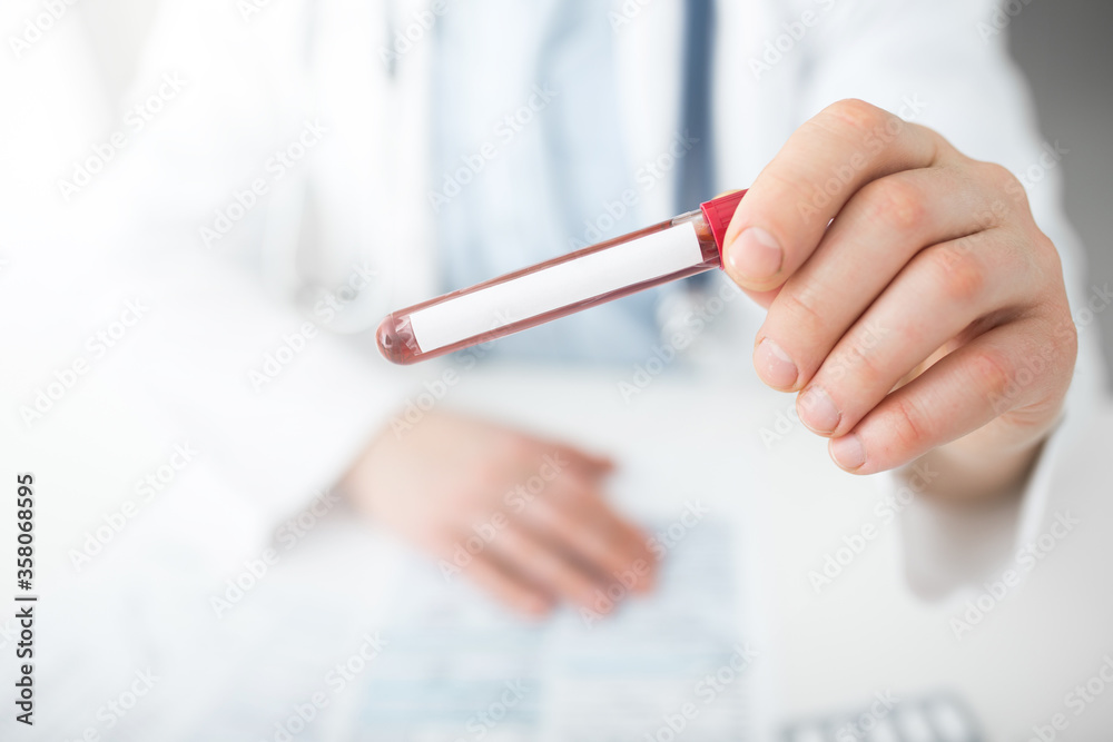 Man doctor with blood test tube in hands