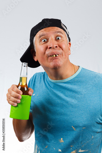 Funny looking man with bad teeth holding a beer