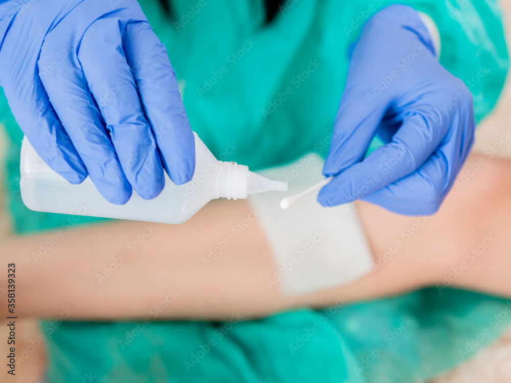 Close-up of a cotton swab and a bottle of antiseptic in the hands of a doctor against the background of a wound on the patient's leg. Close-up of a cotton swab and a bottle of antiseptic in the hands of a doctor against the background of a wound on the patient's leg.