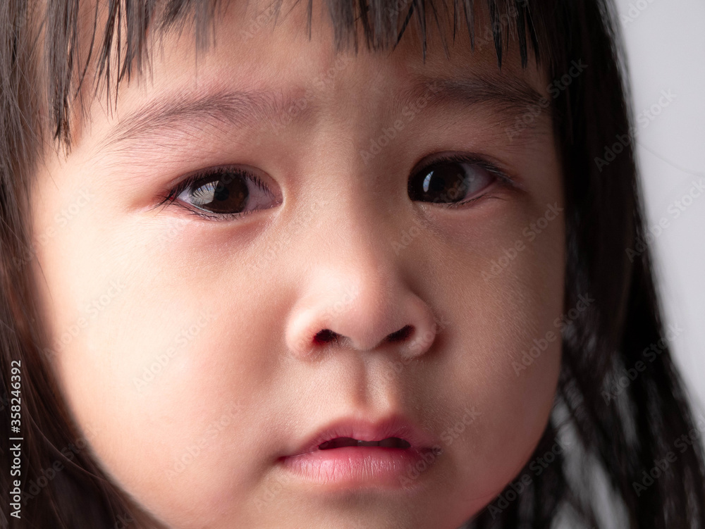 Portrait face of Asian little child girl with sad expression on dark background. Portrait face of Asian little child girl with sad expression on dark background.