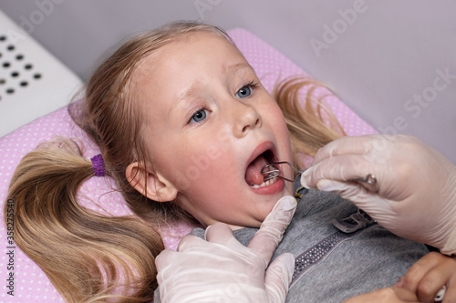Little girl in class with a speech therapist . The use of special tools for speech correction.