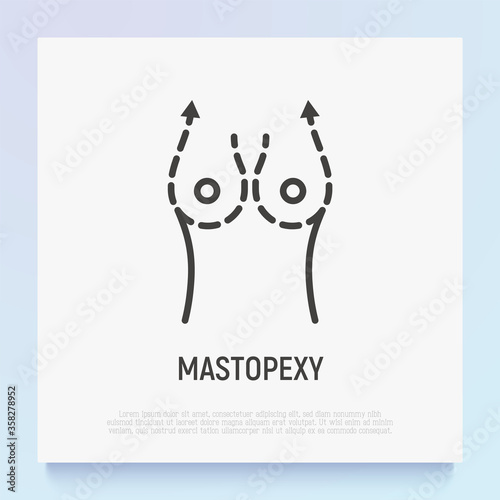 Mastopexy thin line icon. Breast lifting. Modern vector illustration of breast size reduction.