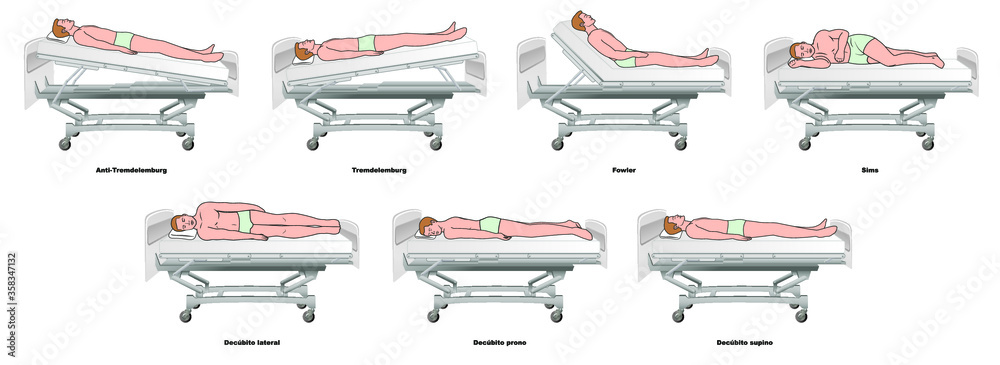  Posiciones paciente en cama hospitalaria - enfermería - obrazy, fototapety, plakaty 