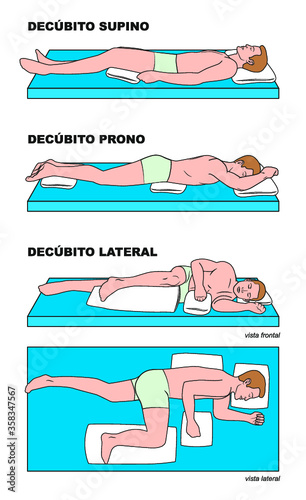 Posturas en cama con almohadas - enfermería