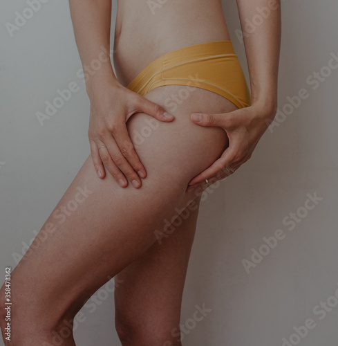 woman touching her hip for looking a cellulite