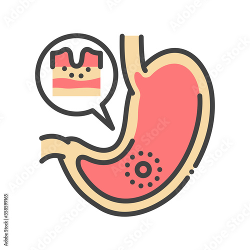 Stomach disease gastritis line color icon. Gastric inflammation. Human organ concept. Sign for web page, mobile app, button, logo. Vector isolated element. Editable stroke