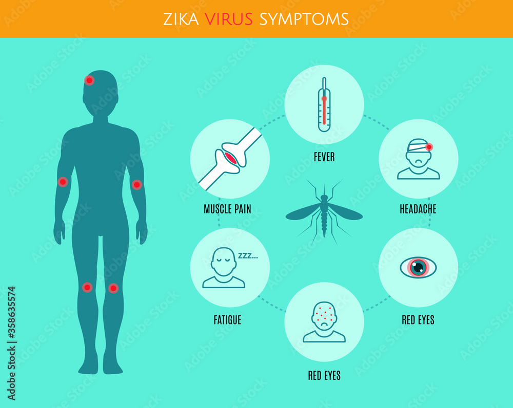 Zika virus symptoms infographics with stick figures, icons, human silhouette and text. Zika virus symptoms infographics with stick figures, icons, human silhouette and text.