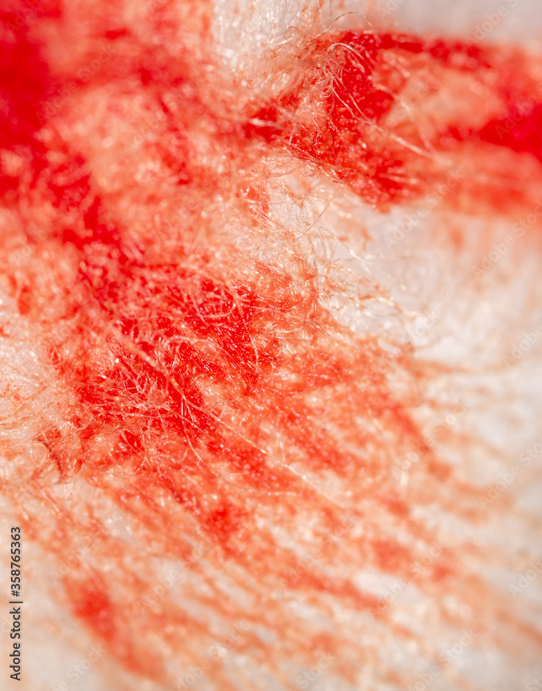 Red human blood on white cotton wool. Red human blood on white cotton wool.