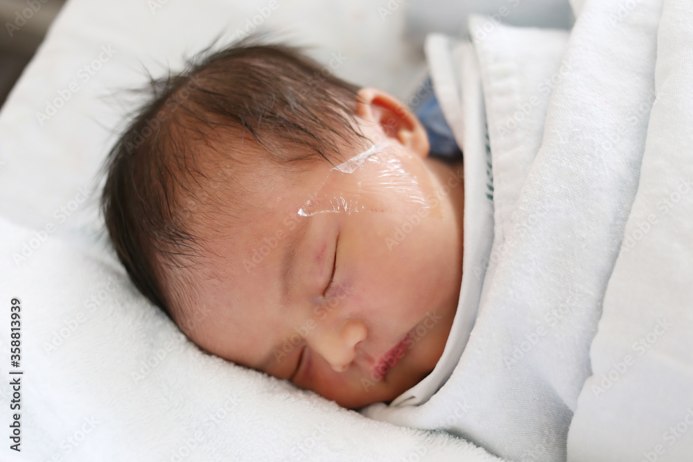 Infant girl of Asian is sleeping on the bed and has a tape to put on her face. Infant girl of Asian is sleeping on the bed and has a tape to put on her face.