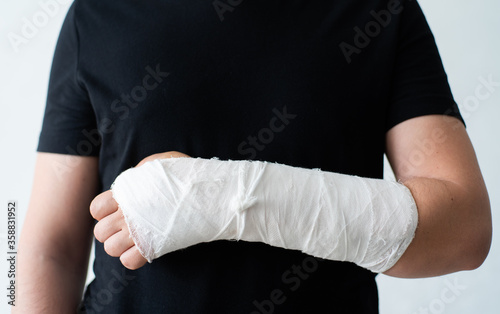 A broken hand in a gypsum bandage. Painful heavy movements of broken finger hands close-up