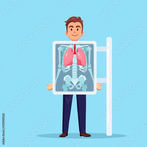 X-ray machine for scanning human lungs. Roentgen of chest bone. Diagnosis of cancer, tuberculosis, pneumonia. Medical examination of respiratory infections for surgery. Vector flat design 