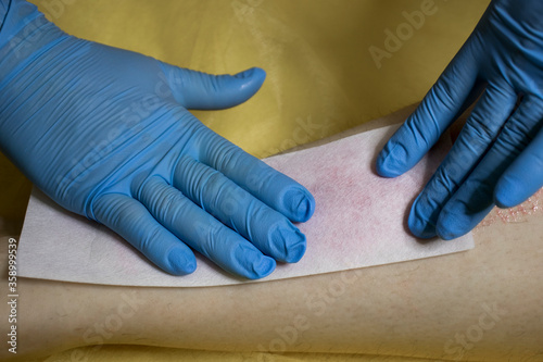 Beautician in blue gloves makes wax depilation.