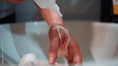 girl pours peroxide on a wounded arm photo