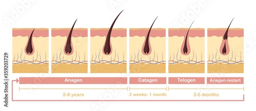 Hair growth cycle illustration. Anatomical diagram of development hair follicles from anagen telagen care papillae skin epidermis and health promoting stimulation vector growth hair cells. photo