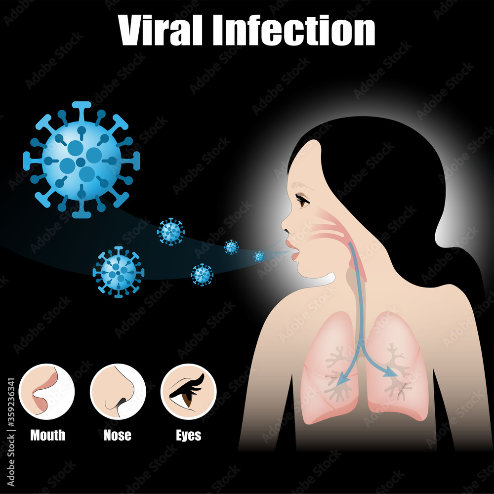 Can Winged Invaders Really Infection Their Way Into Your Body?