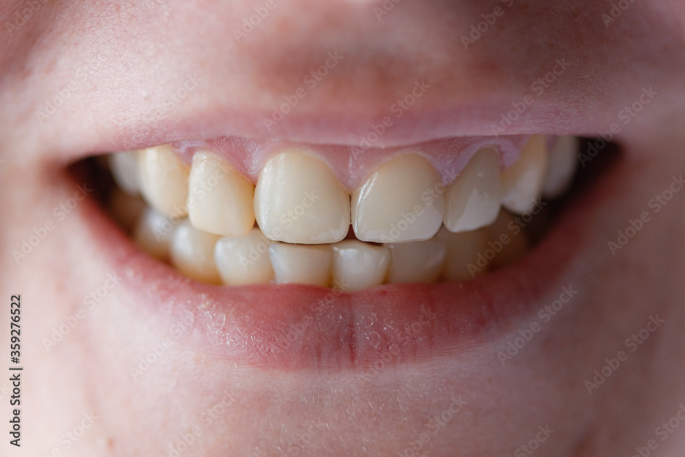 Fototapeta premium Woman's mouth with white teeth.