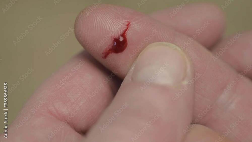 Paper cut on finger with drop of blood close up