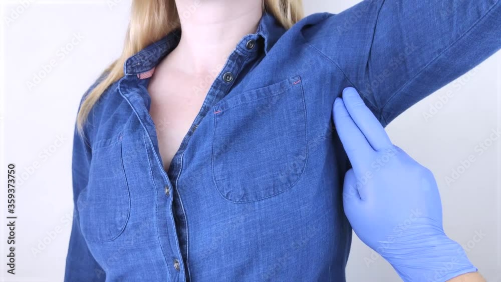 A woman suffers from pain in the armpit. Sweating, unpleasant odor, redness, itching and