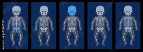Skeleton x ray