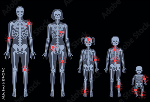Skeleton x ray