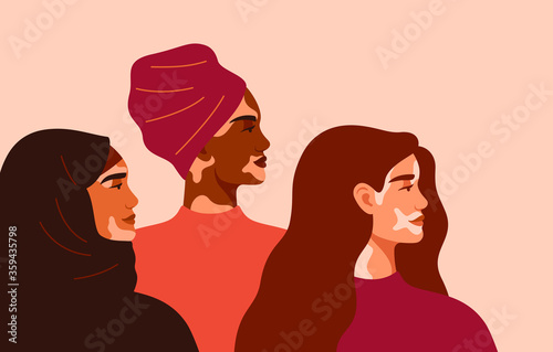 Three women with vitiligo of different nationalities standing together. Concept to support people living with vitiligo and to build awareness about chronic skin disorder.Vector illustration